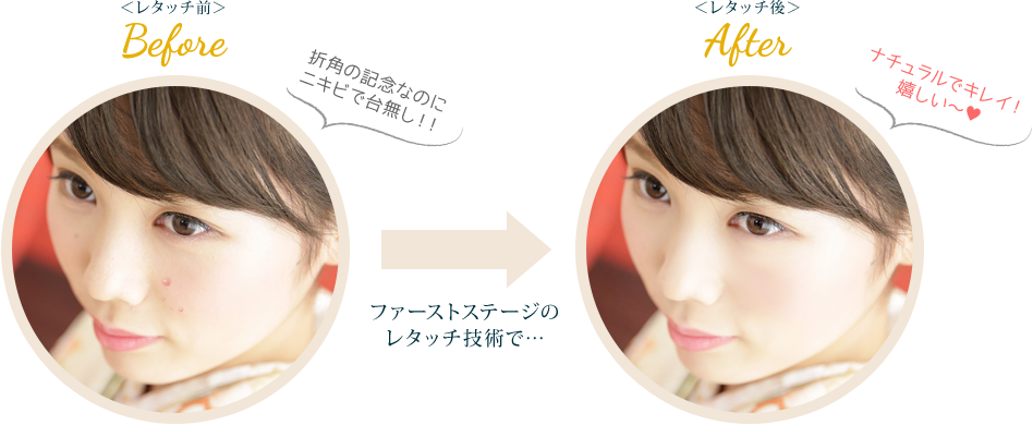 美肌before after